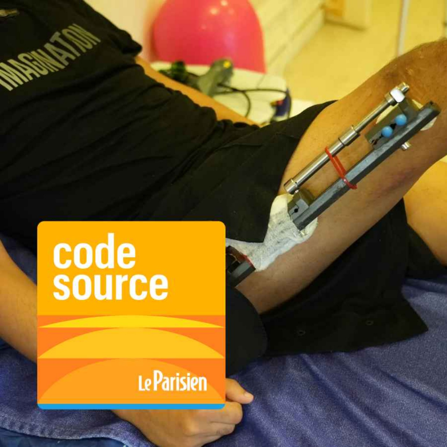 Allongement des jambes en Turquie : notre reporter raconte cette tendance risquée Allongement des jambes en Turquie : notre reporter raconte cette tendance risquée