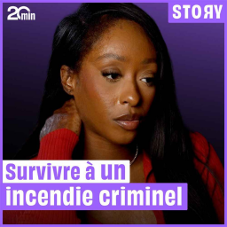 Grace, brûlée à 60 % lors d’un incendie criminel